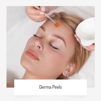derma peels